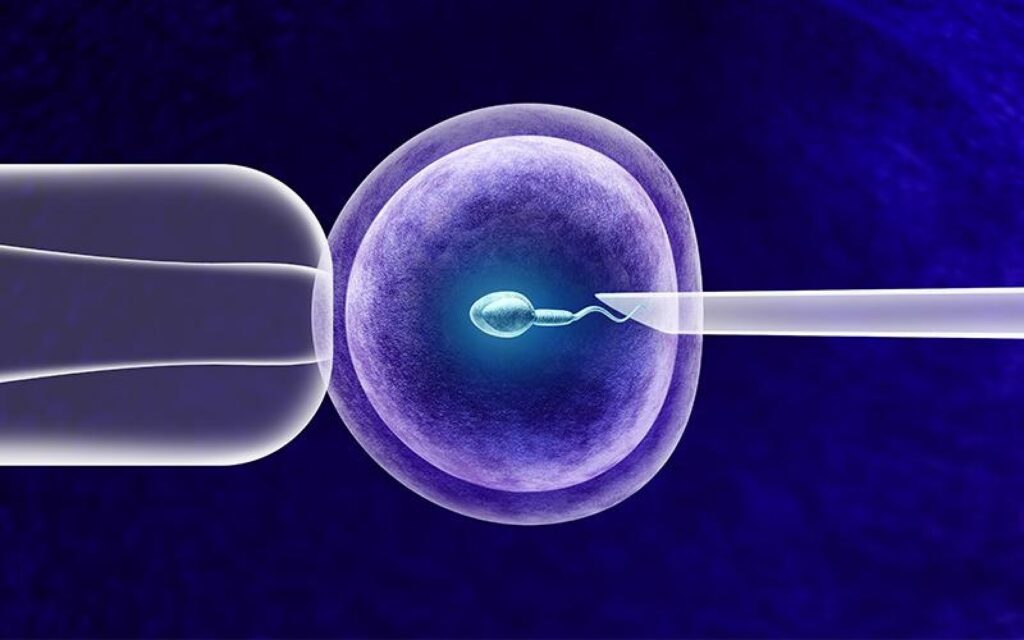 Fetilização in vitro