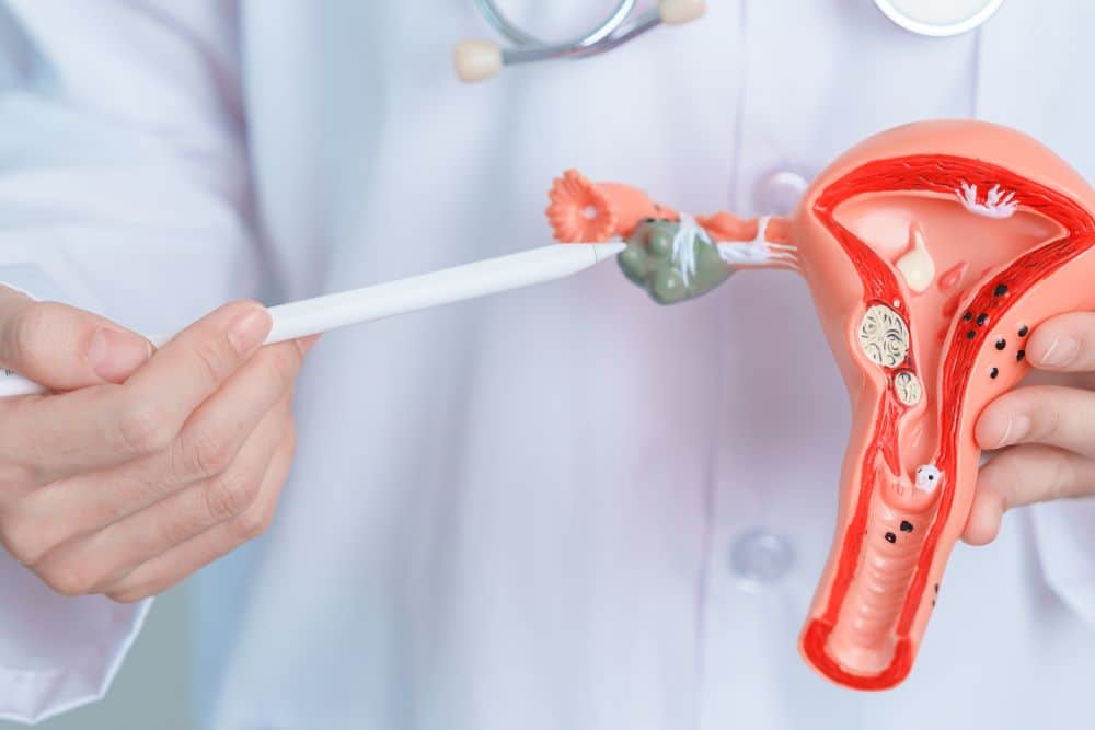 Endometriose e Mioma Uterino: entenda a diferença
