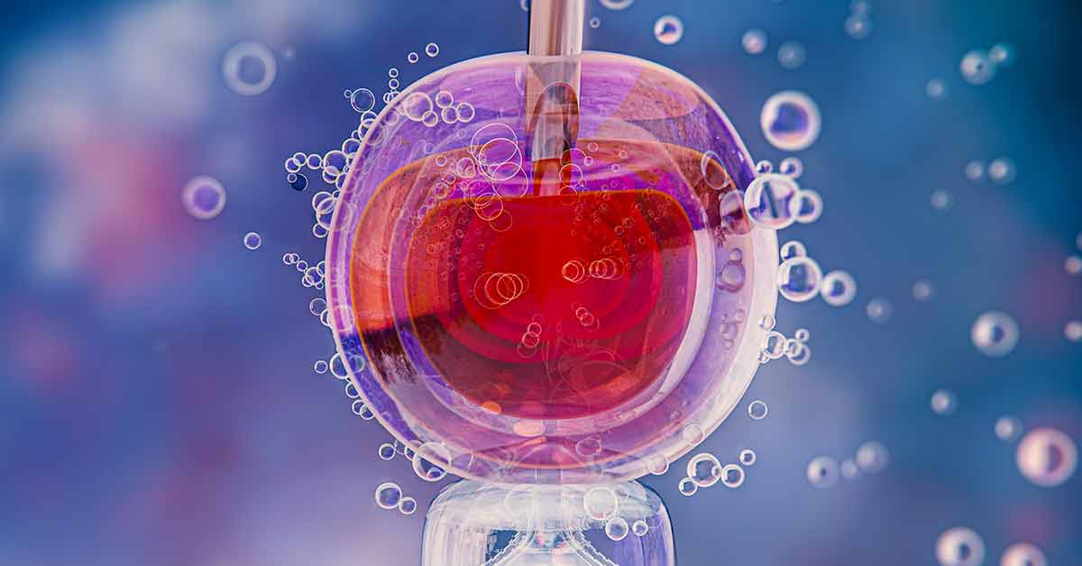 Diferenças entre ICSI e Fertilização In Vitro